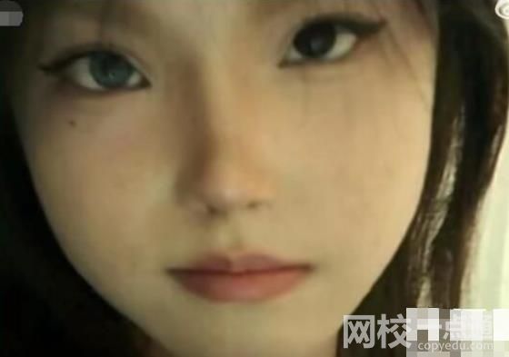 18歲女孩右眼天生藍瞳 具體是什么情況?