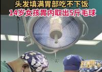 女孩吃頭發胃里取出5斤毛球 孩子異食癖很多年頭發都快薅沒了