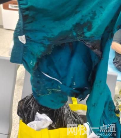 廣州警方通報男孩地鐵里被硫酸灼傷 車廂地面居然有硫酸究竟是怎么回事
