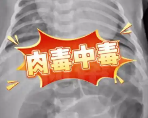 52天嬰兒喝奶奶喂的蜂蜜水中毒進ICU 究竟是怎么回事？