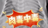 52天嬰兒喝奶奶喂的蜂蜜水中毒進(jìn)ICU 究竟是怎么回事？