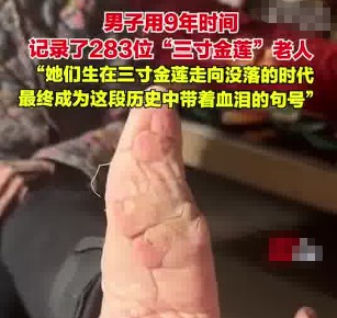 男子用9年時間記錄了283位裹腳老人 為什么引爭議？