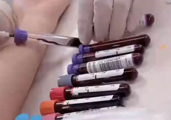 醫生:胖人比瘦人更能抗病 到底是不是真的？