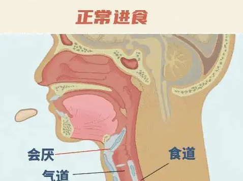 26歲女孩突發會厭炎僅10分鐘去世 實在太可怕了