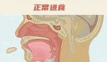 26歲女孩突發會厭炎僅10分鐘去世 實在太可怕了