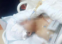 貴州一男子被野豬咬成重傷 究竟是怎么回事？
