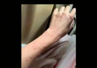 女演員貴州拍戲遇極端天氣 胳膊受傷 實在太嚇人了