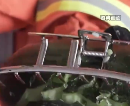 女子戴鯊魚夾騎電車摔倒致頭骨骨折 實在太悲劇了
