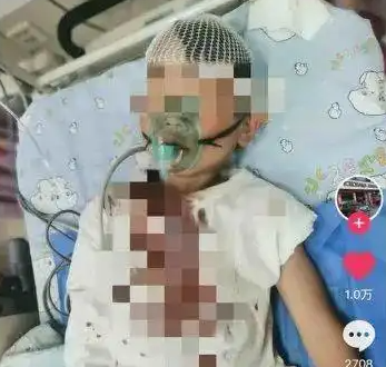 8歲男童被醉漢砸頭 或需做開(kāi)顱手術(shù) 實(shí)在太悲劇了